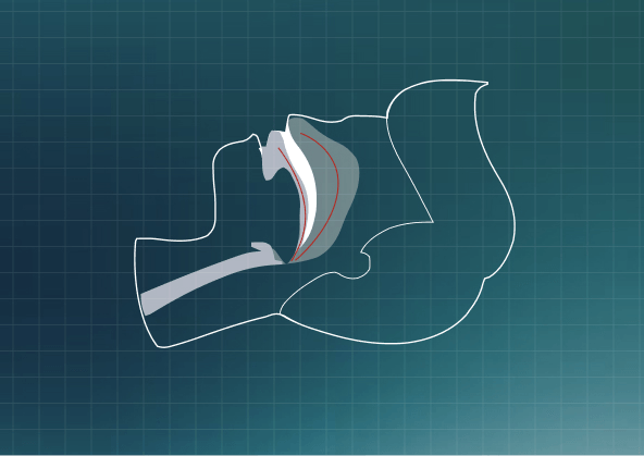 Your airway collapses